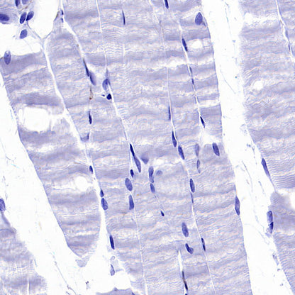 PTK7 Recombinant Rabbit mAb (SDT-2432-136)