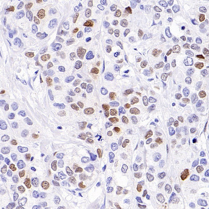 p21 Waf1/Cip1 Recombinant Rabbit mAb (SDT-1349-71)
