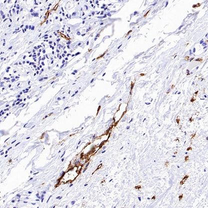LYVE1 Recombinant Rabbit mAb (S-3786-26)