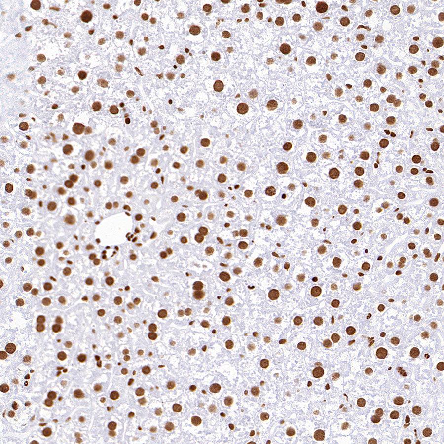 TriMethyl-Histone H3 (K36) Recombinant Rabbit mAb (S-M0025)