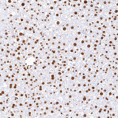 TriMethyl-Histone H3 (K36) Recombinant Rabbit mAb (S-M0025)