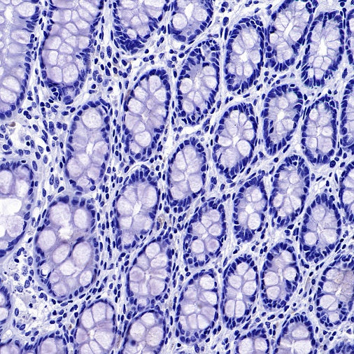 FOXL2 Recombinant Rabbit mAb (SDT-557-361)