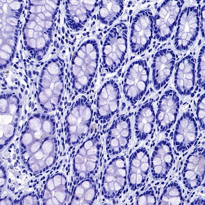 FOXL2 Recombinant Rabbit mAb (SDT-557-361)