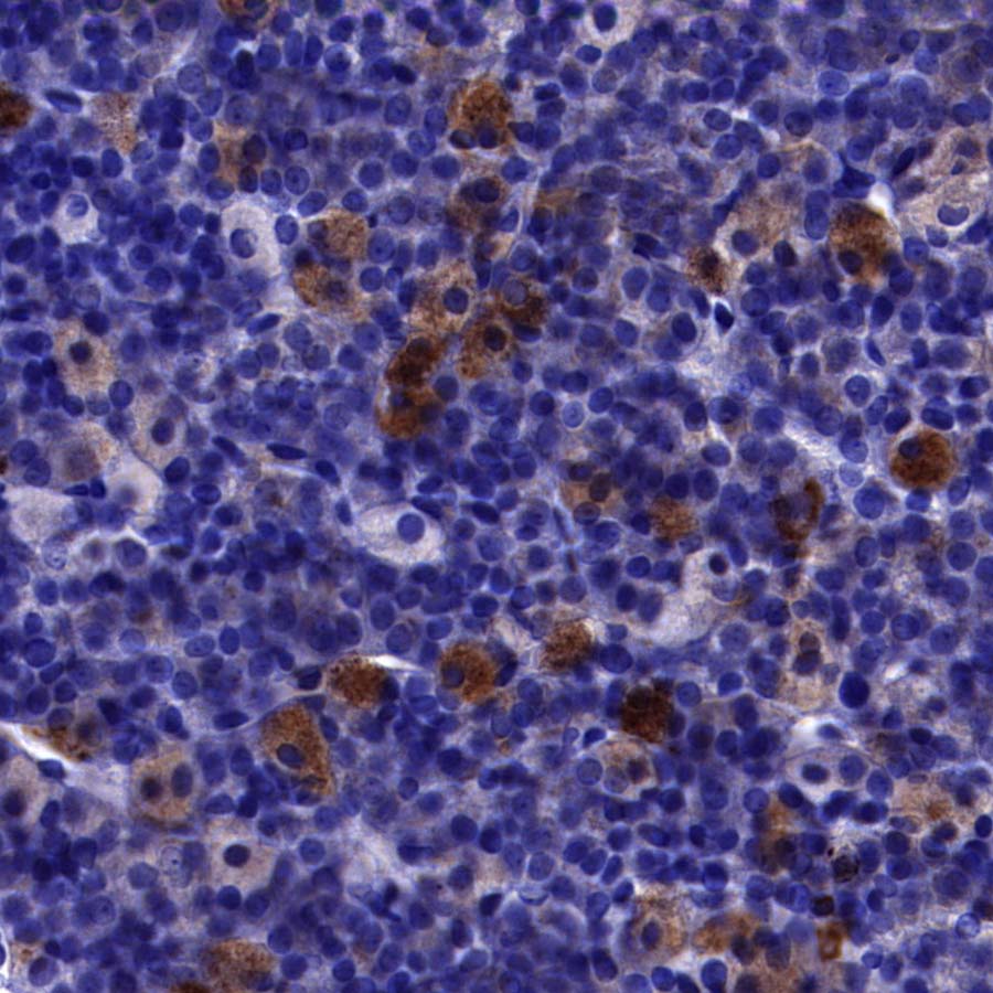 NPTX2 Recombinant Rabbit mAb (S-4048-54)
