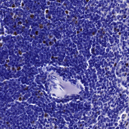 Ki67 Recombinant Mouse mAb (SDT-606-7)