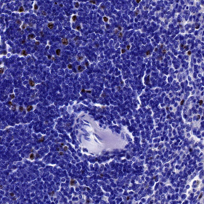 Ki67 Recombinant Mouse mAb (SDT-606-7)