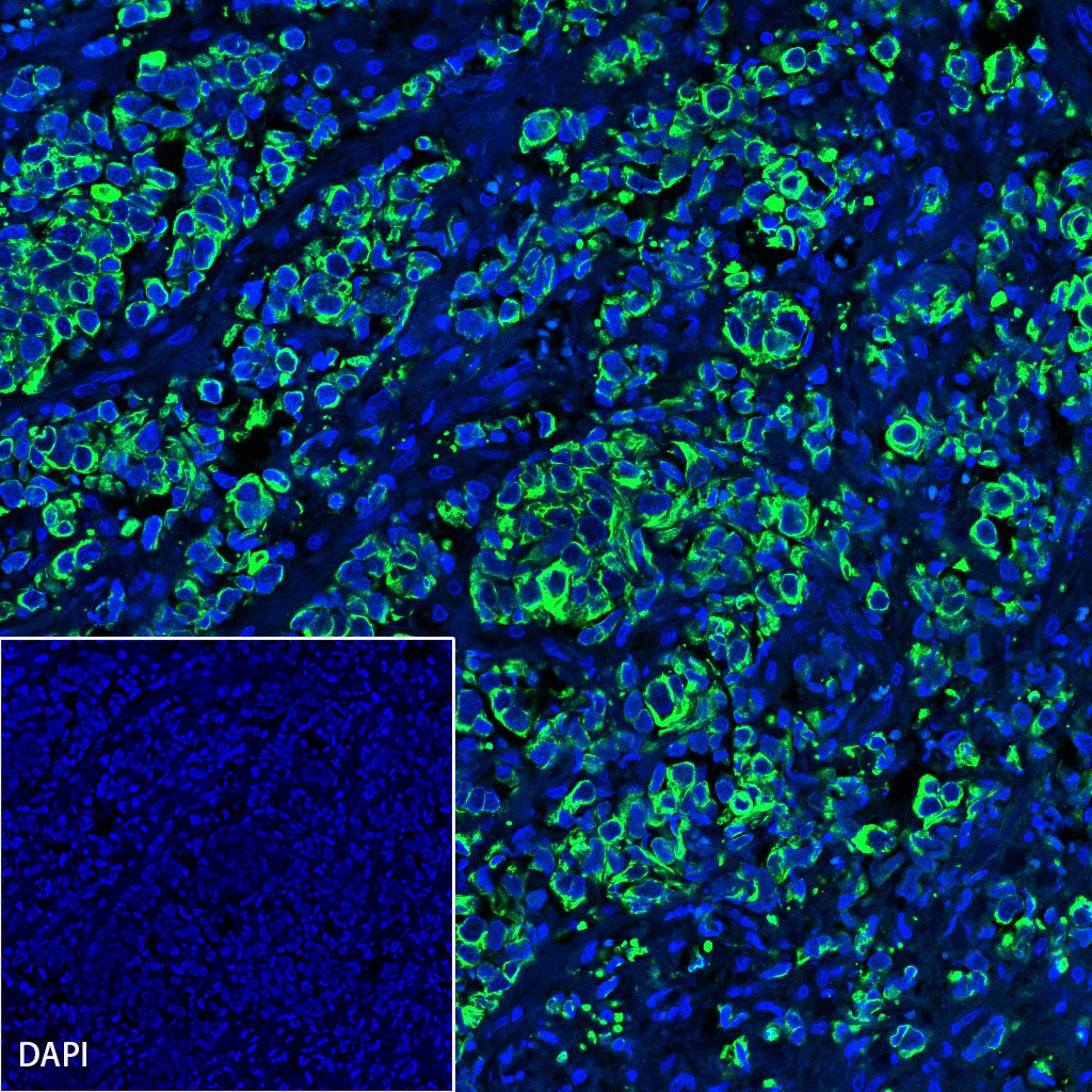 S-RMab® CK-Pan Recombinant Rabbit mAb,PBS Only (SDT-P001)