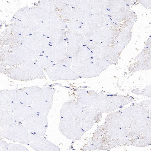 ASC/TMS1 Rabbit Polyclonal Antibody