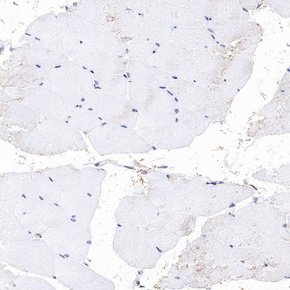 ASC/TMS1 Rabbit Polyclonal Antibody