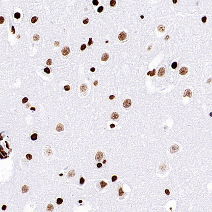Histone H3 (acetyl K9) Recombinant Rabbit mAb (S-1704-76)