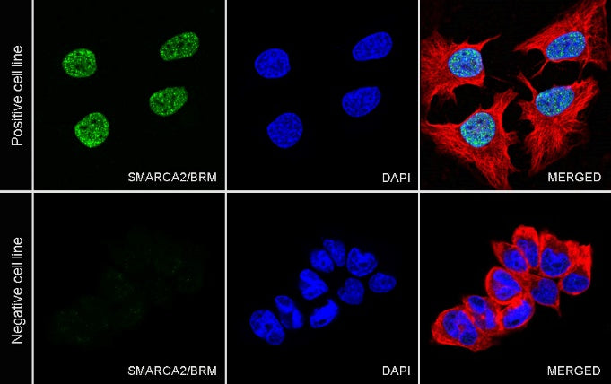 SMARCA2/BRM Recombinant Rabbit mAb (S-1568-17)
