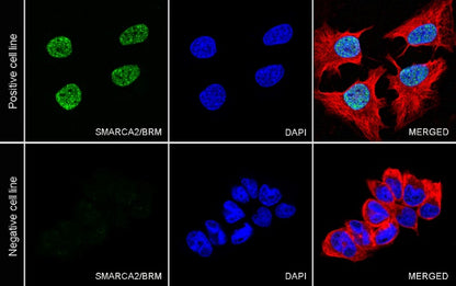 SMARCA2/BRM Recombinant Rabbit mAb (S-1568-17)
