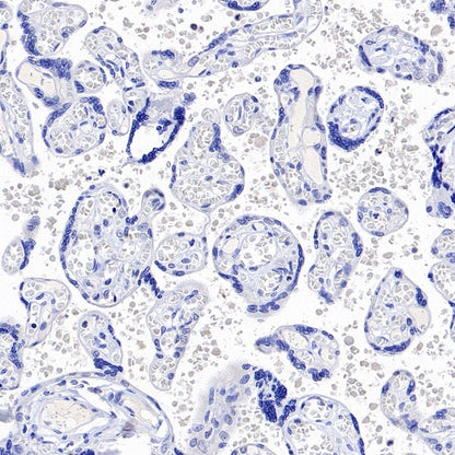 ASGR1 Rabbit Polyclonal Antibody