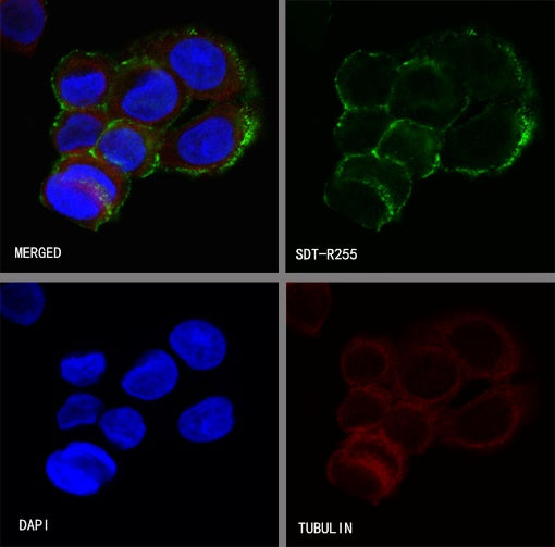 Villin Recombinant Rabbit mAb (SDT-R255)