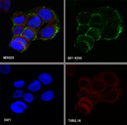 Villin Recombinant Rabbit mAb (SDT-R255)