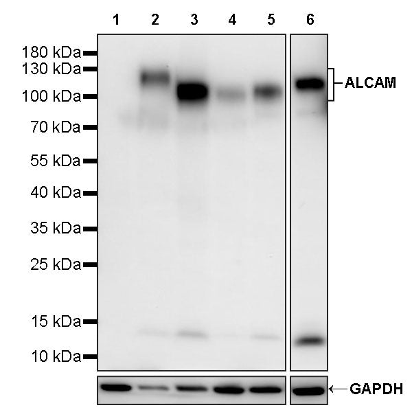 ALCAM Recombinant Rabbit mAb (S-4080-21)