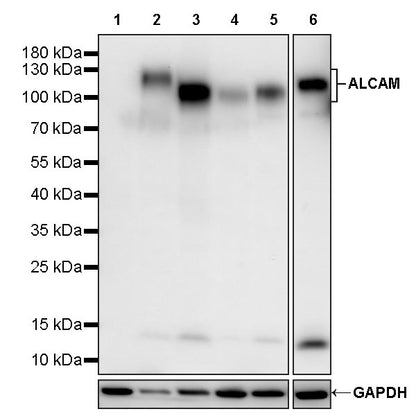 ALCAM Recombinant Rabbit mAb (S-4080-21)