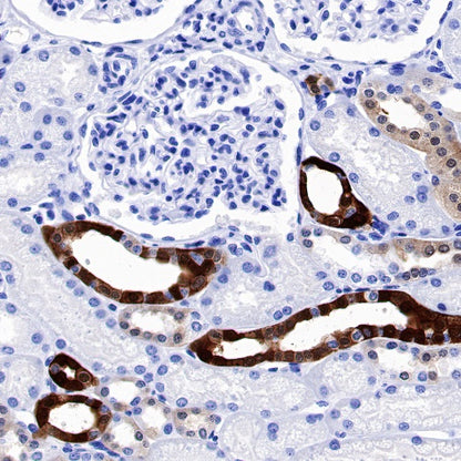 Parvalbumin Recombinant Rabbit mAb (S-1620-10)