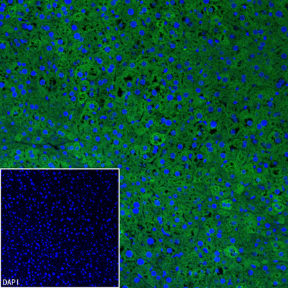 Pklr Recombinant Rabbit mAb (S-4114-40)