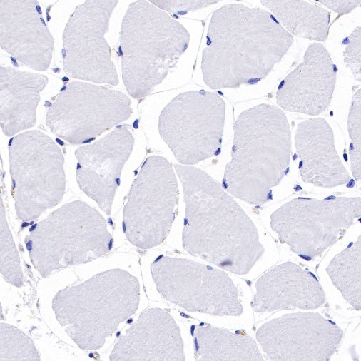 Non-muscle Myosin IIB/MYH10 Recombinant Rabbit mAb (S-299-3)