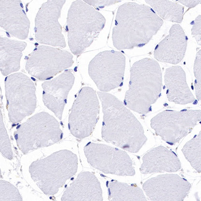 Non-muscle Myosin IIB/MYH10 Recombinant Rabbit mAb (S-299-3)