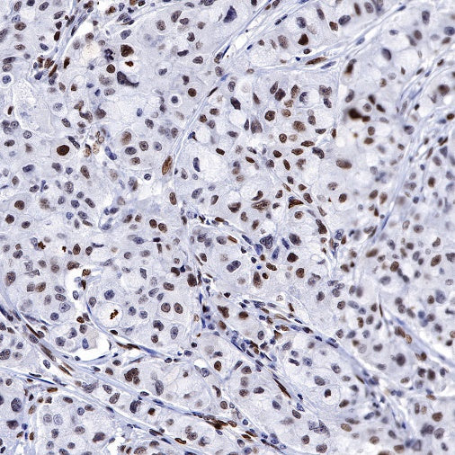 JunB Recombinant Rabbit mAb (S-R294)