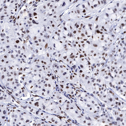 JunB Recombinant Rabbit mAb (S-R294)