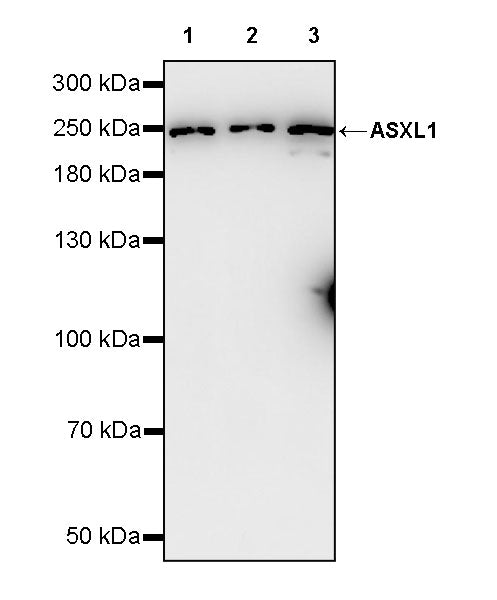 ASXL1 Recombinant Rabbit mAb (S-4409-30)