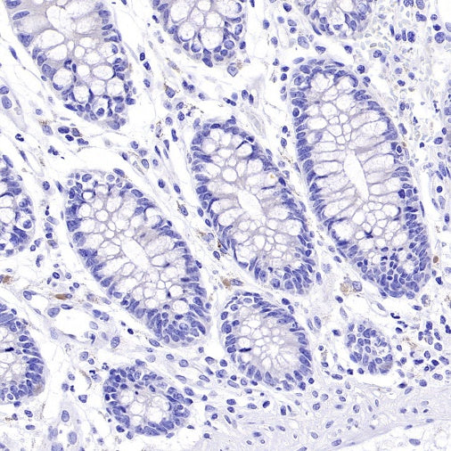 ALPG Rabbit Polyclonal Antibody