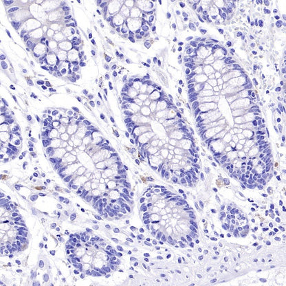 ALPG Rabbit Polyclonal Antibody