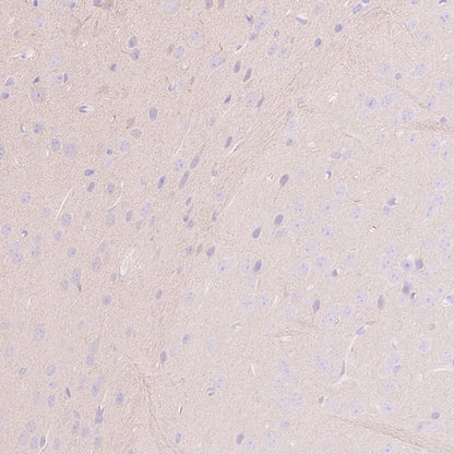 IRGQ Recombinant Rabbit mAb (S-2648-17)