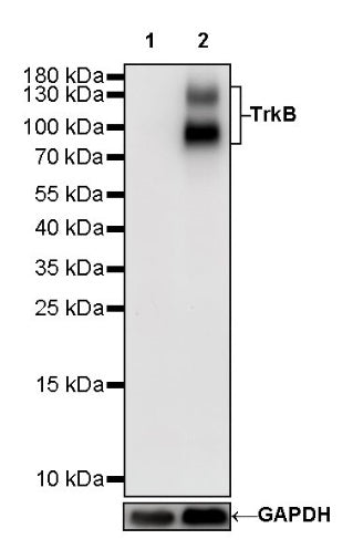 TrkB Recombinant Rabbit mAb (S-488-5)