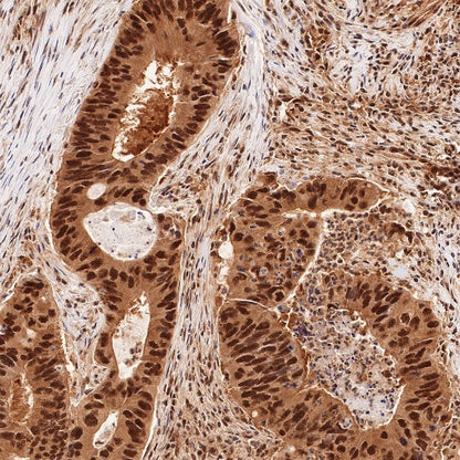 RBX1 Recombinant Rabbit mAb (S-R355)