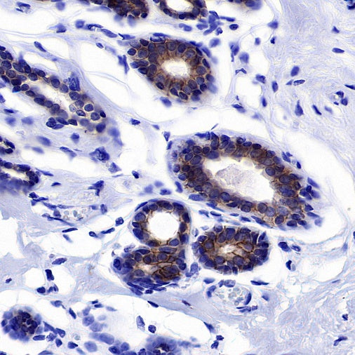 ErbB3 Recombinant Rabbit mAb (SDT-991-73)