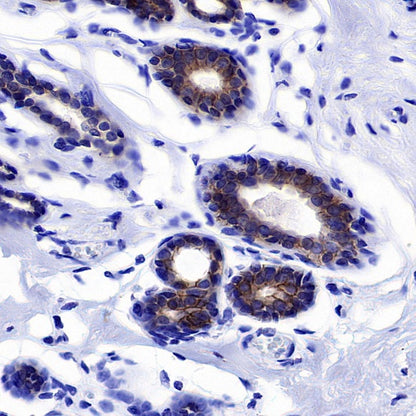 ErbB3 Recombinant Rabbit mAb (SDT-991-73)
