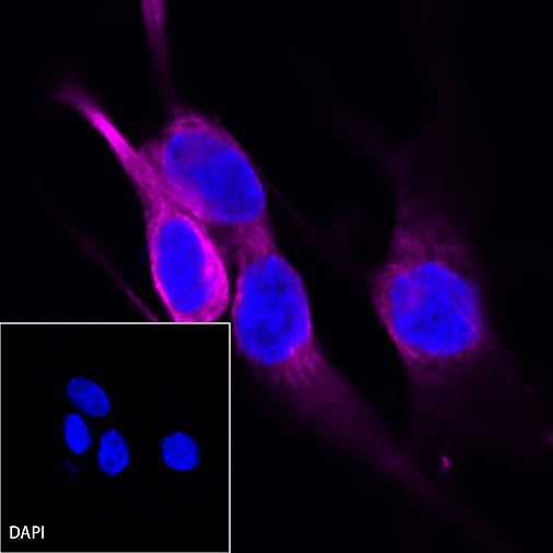 β-tubulin Recombinant Rabbit mAb (Alexa Fluor®647 Conjugate) (S-312-113)
