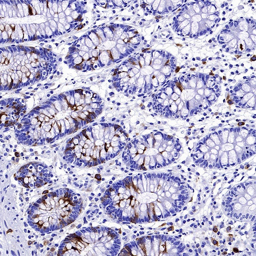 TACC3 Recombinant Rabbit mAb (S-3048-50)