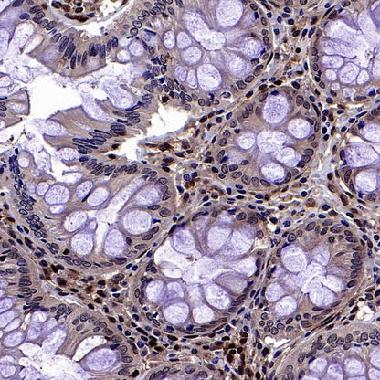 Stat5b Recombinant Rabbit mAb (S-2951-34)