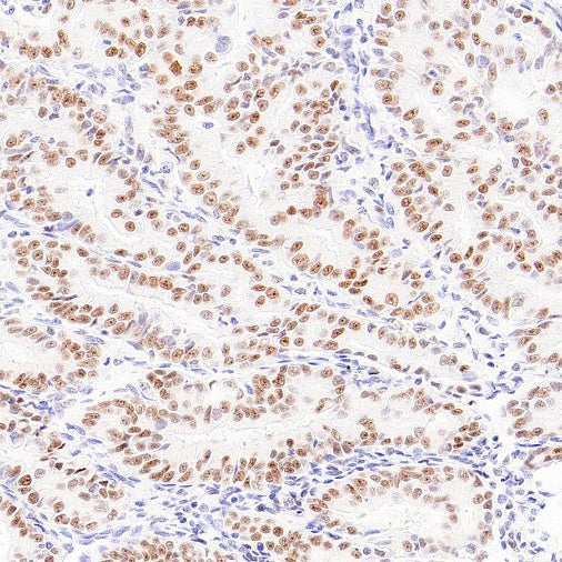 FOXP4 Recombinant Rabbit mAb (S-6198)