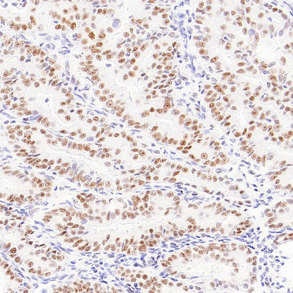 FOXP4 Recombinant Rabbit mAb (S-6198)