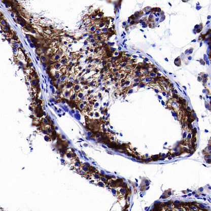 PTGES Recombinant Rabbit mAb (S-4351-18)