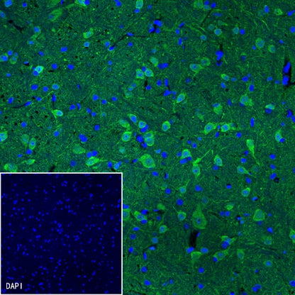 UCHL1 Rabbit Polyclonal Antibody