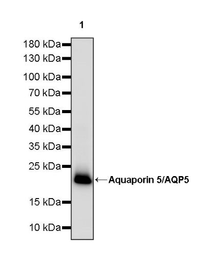 Aquaporin 5/AQP5 Recombinant Rabbit mAb (S-1610-43)