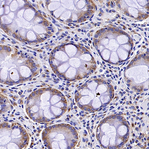 M6PR Recombinant Rabbit mAb (S-1480-21)