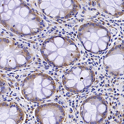 M6PR Recombinant Rabbit mAb (S-1480-21)