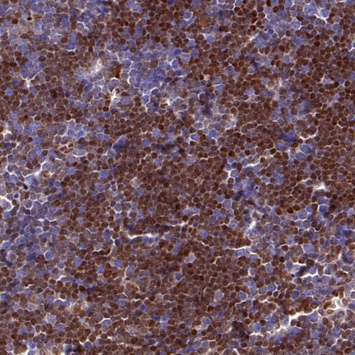 p27 Recombinant Rabbit mAb (S-141-135)