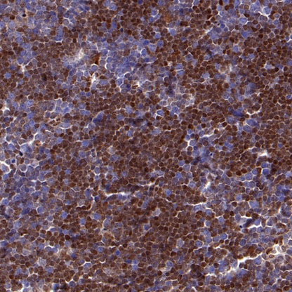 p27 Recombinant Rabbit mAb (S-141-135)