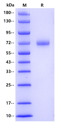 Human Serpin A10 Protein, His tag