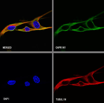 CAPRIN1 Mouse mAb