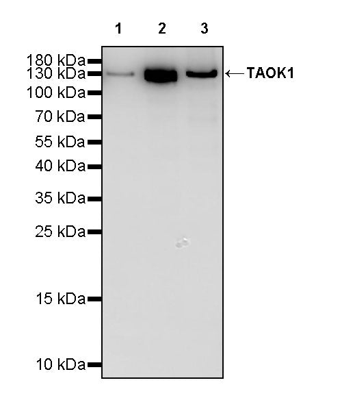 TAOK1 Recombinant Rabbit mAb (S-3673-80)